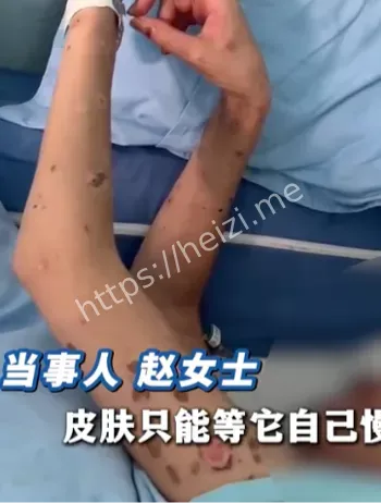 高颜值女子毁容