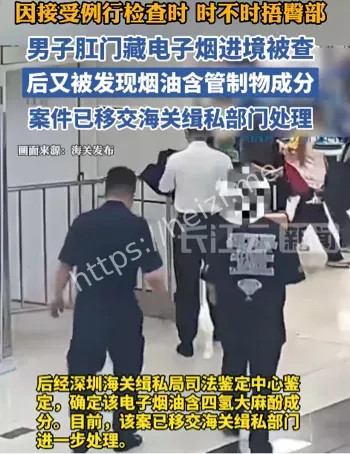 肛门夹藏电子烟风险